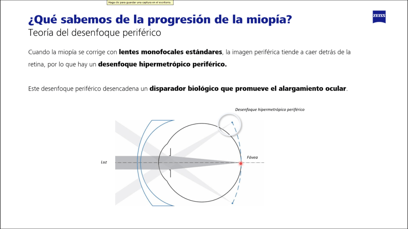 Progresión de la miopía